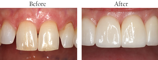 dental images 46037